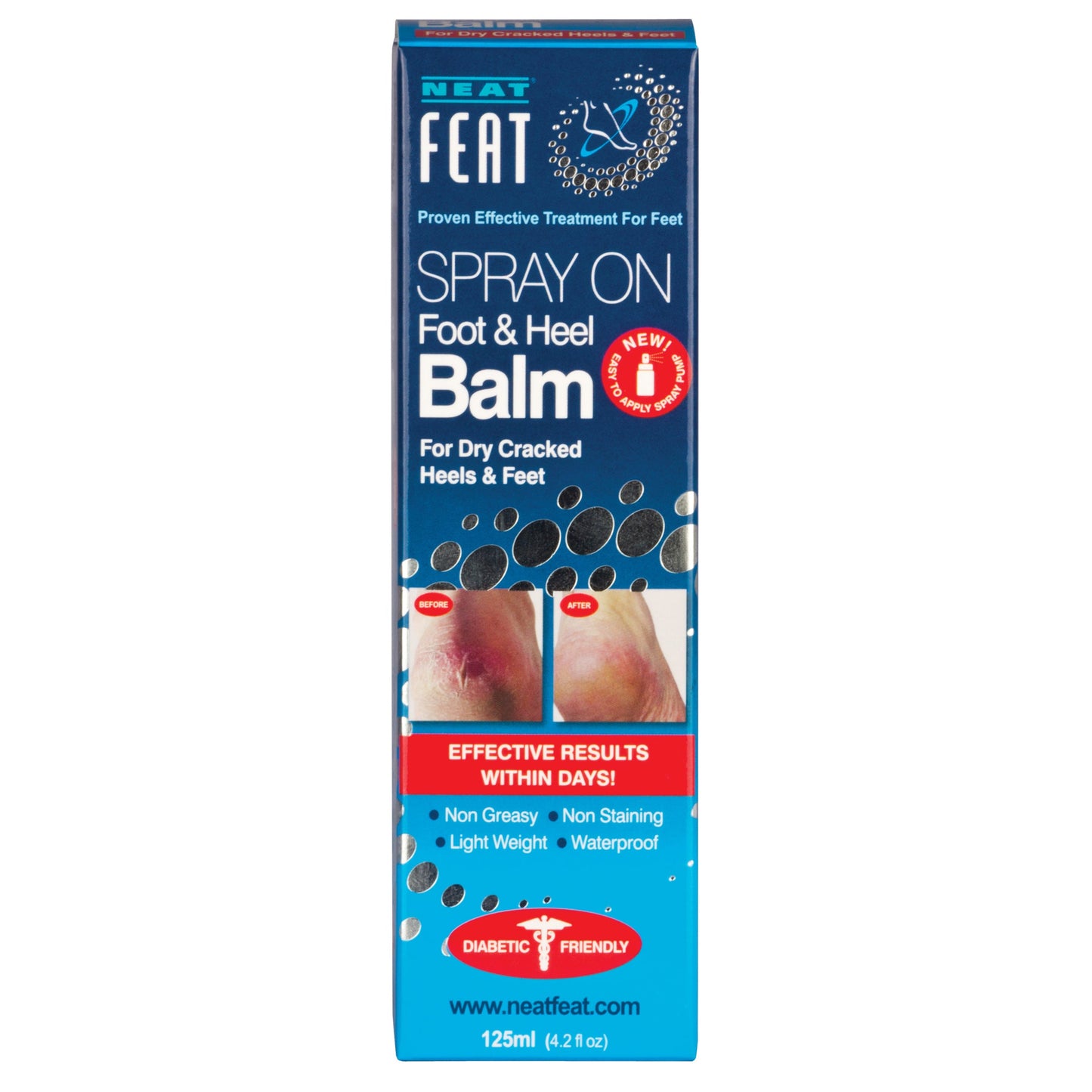 Neat Feat Foot & Heel Balm Spray 125ml - Cutprice Online