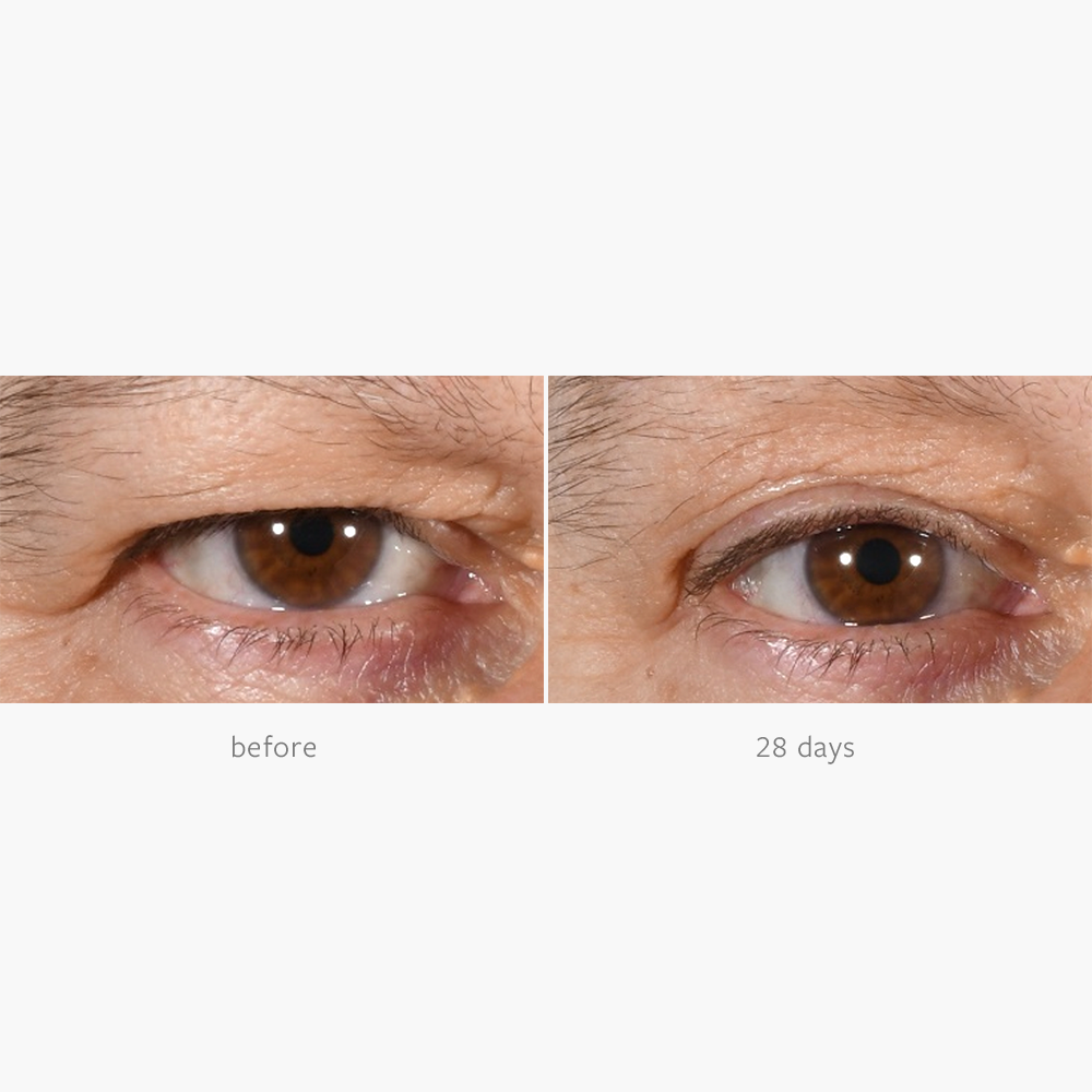 Freezeframe Non-surgical Eyelid Lift 15ml - Cutprice Online