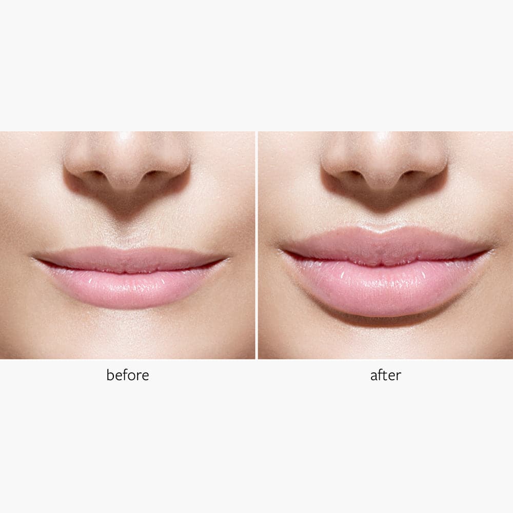 Freezeframe Lip Injection 10ml - Cutprice Online