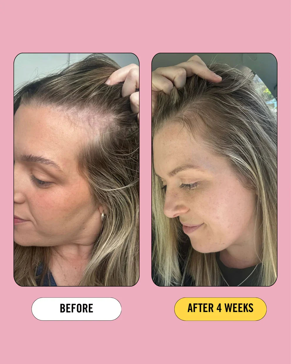 Growth Bomb Post Pregnancy Prebiotic Rescue Serum 80mL