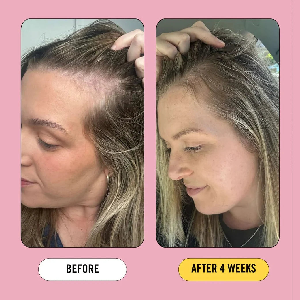 Growth Bomb Post Pregnancy Prebiotic Rescue Serum 80mL