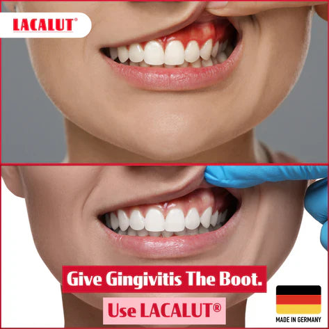 300ml LACALUT Aktiv Mouthwash