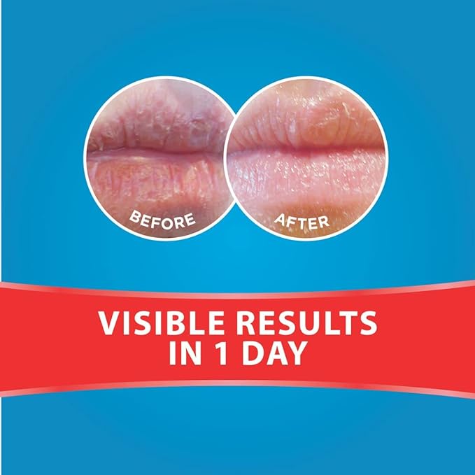 Dermal Therapy Lip Balm Stick 4.8g - Cutprice Online