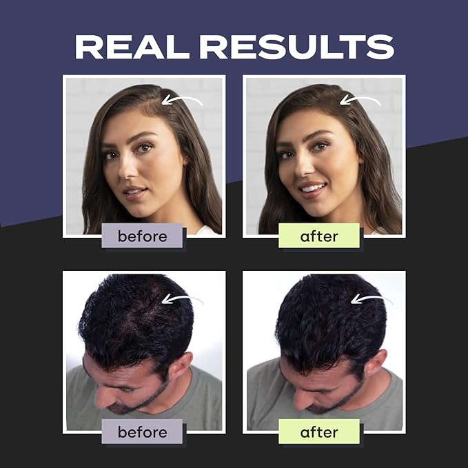 Toppik Hair Building Fibres 27.5g  Black - Cutprice Online
