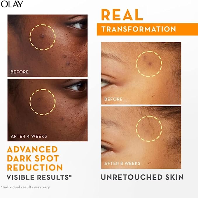 Olay Luminous Vitamin C Super Serum 30ml - Cutprice Online