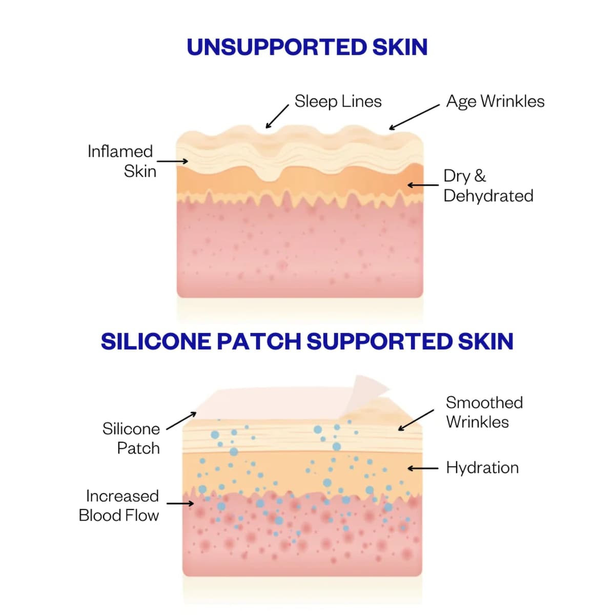 Wrinkles Schminkles Mouth & Lip Wrinkle Patch - Cutprice Online