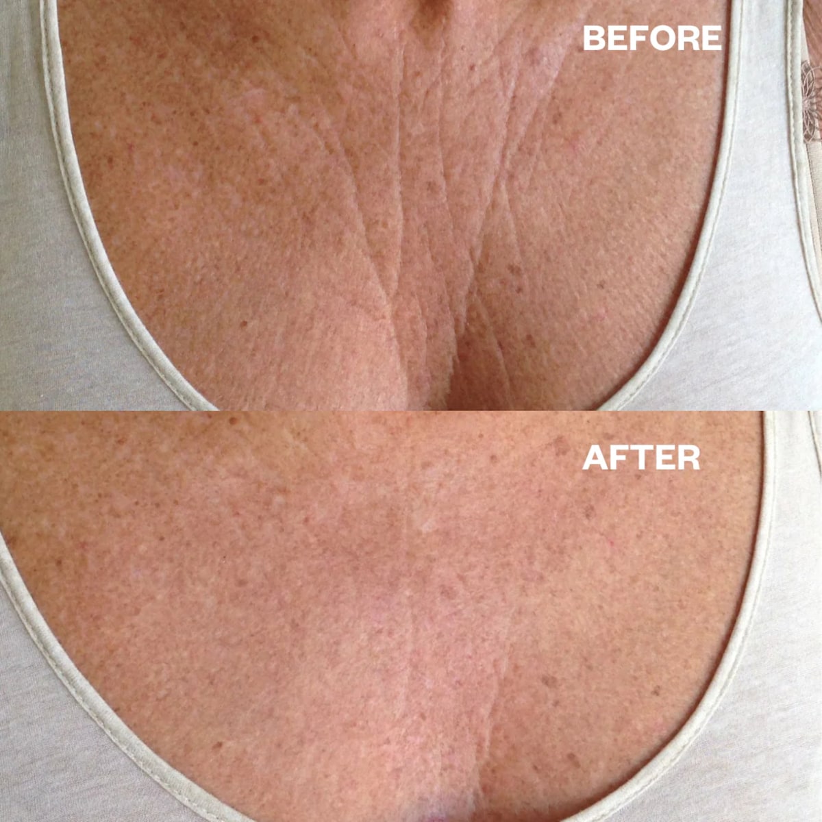 Wrinkles Schminkles Chest Wrinkle Patch Single - Cutprice Online