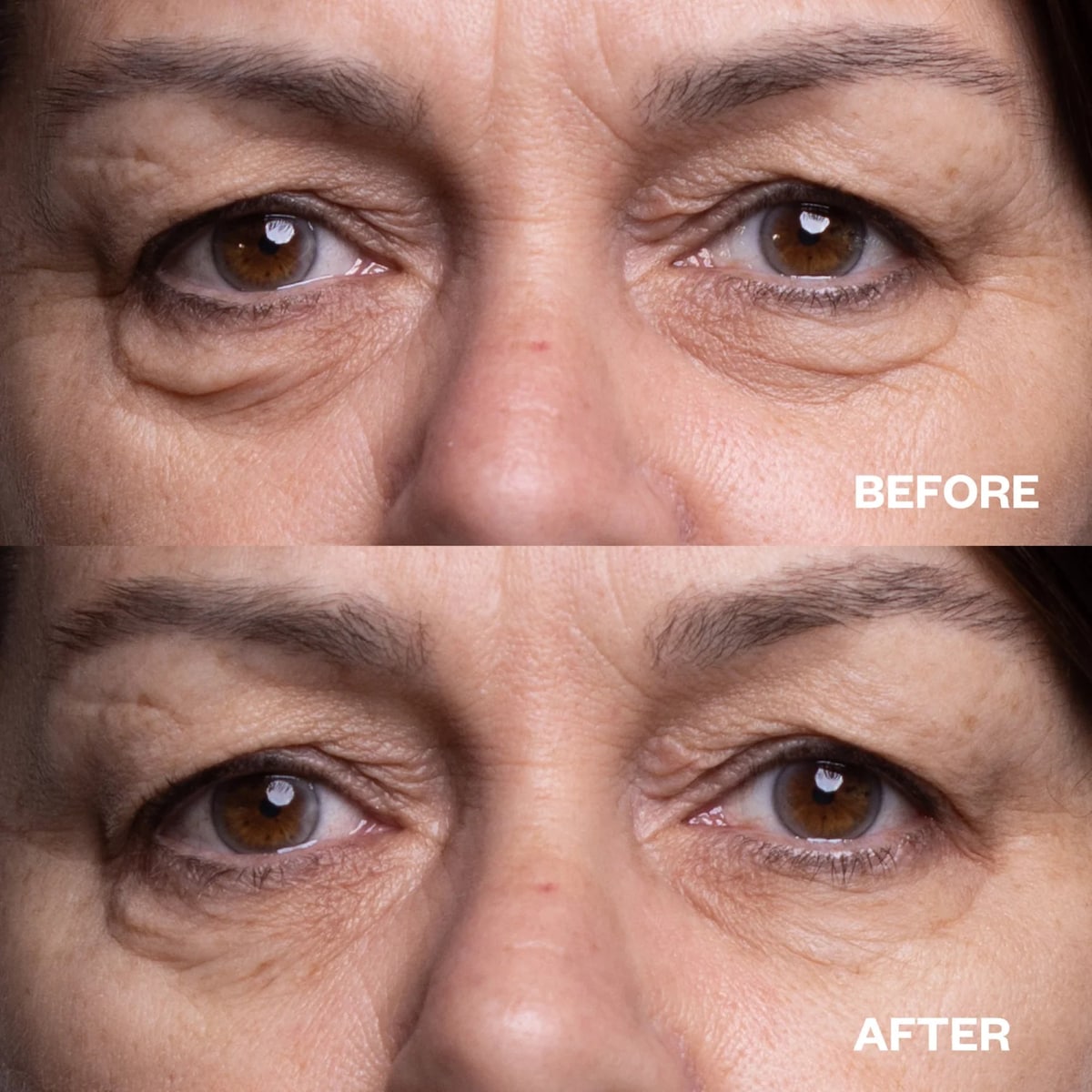 Wrinkles Schminkles Eye Wrinkle Patches - Cutprice Online