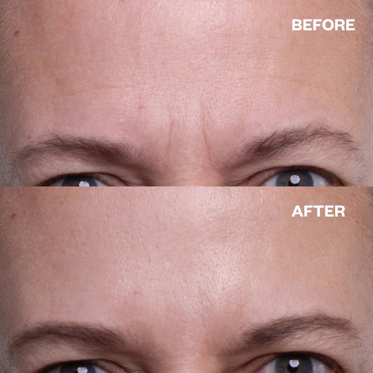 Wrinkles Schminkles Forehead Wrinkle Patch Single - Cutprice Online