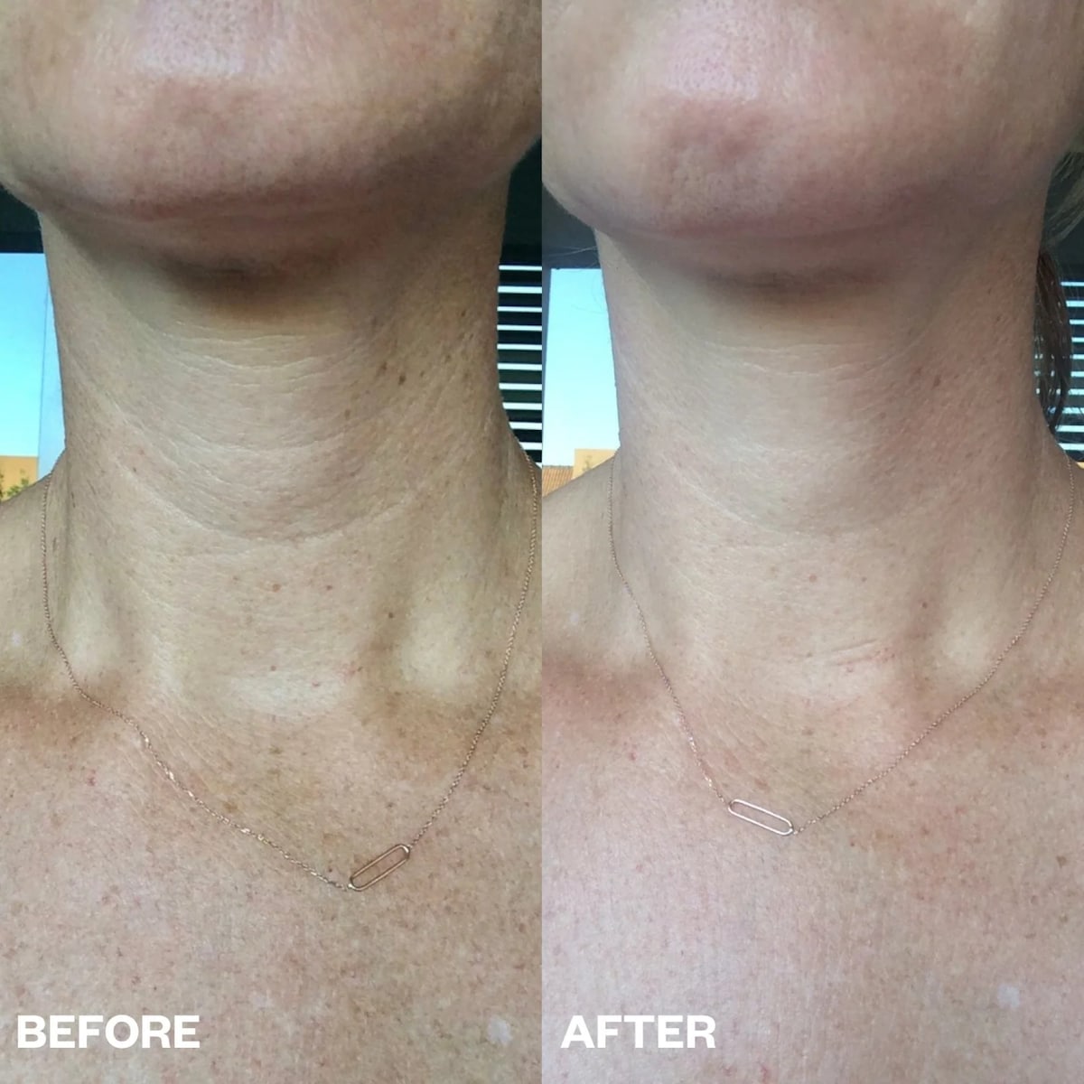 Wrinkles Schminkles Neck Wrinkle Patch Single - Cutprice Online