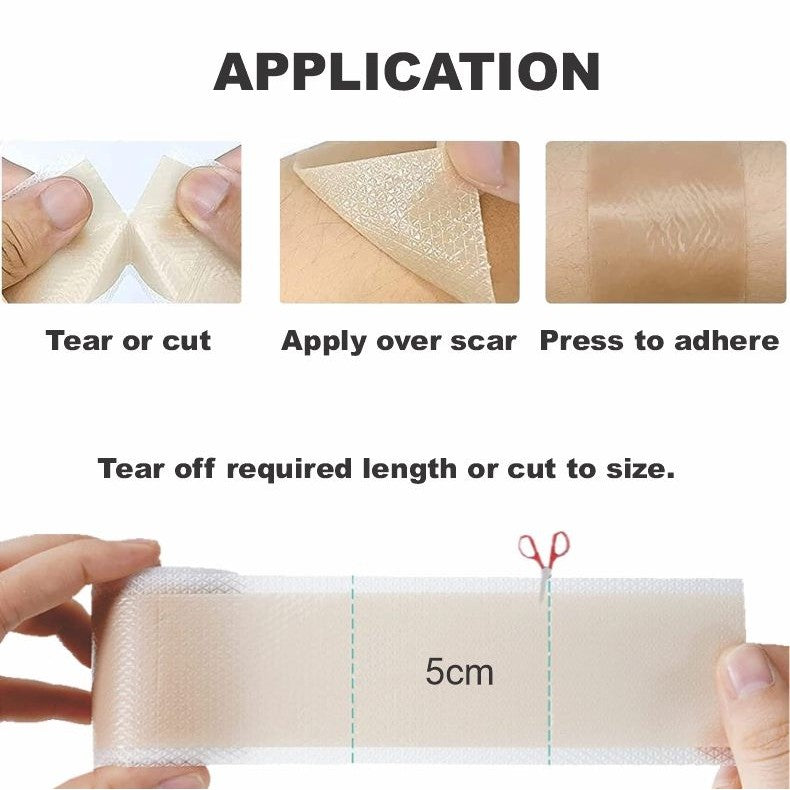 Bodyassist Silicone Scar Tape 4cm X 1.5m