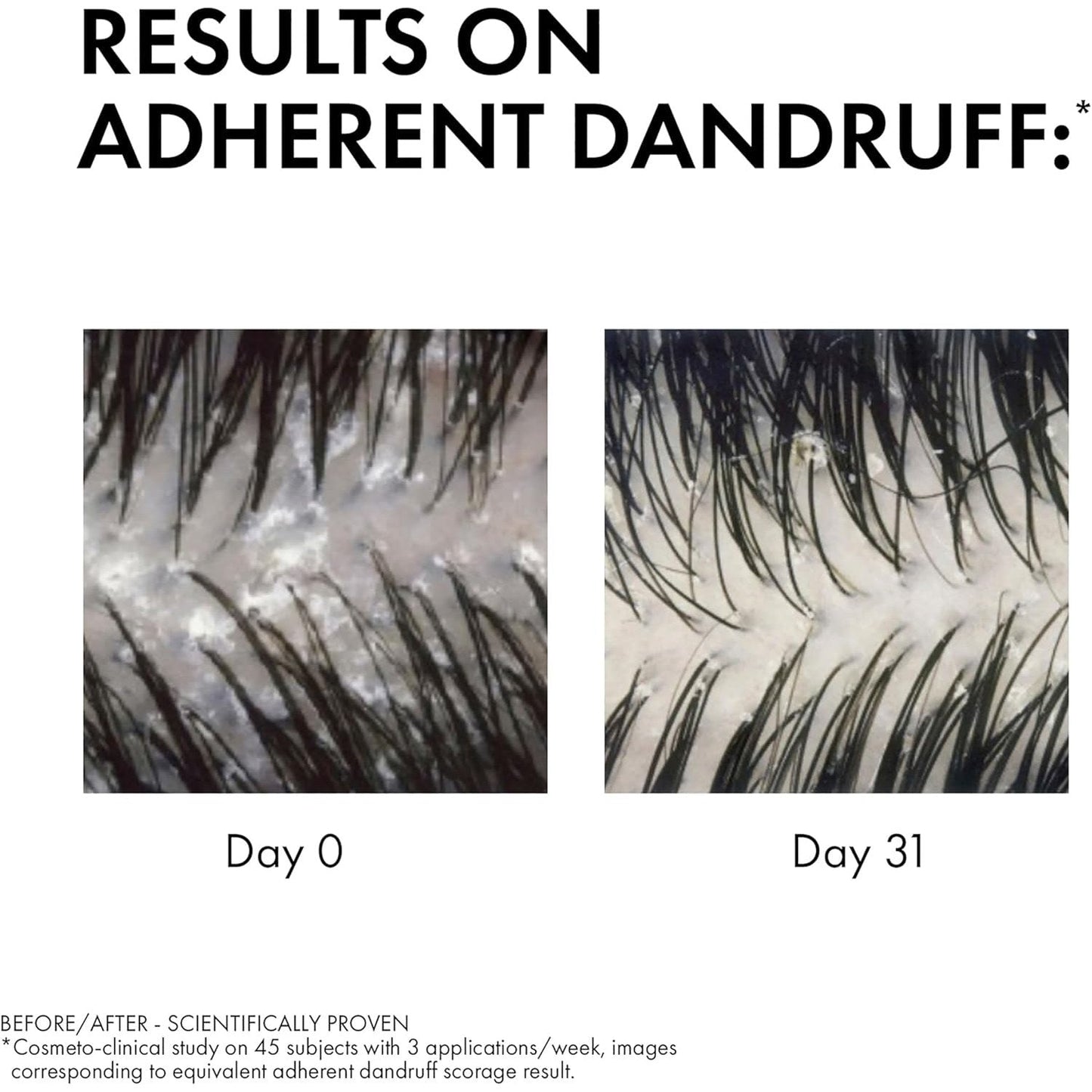 Dercos Anti-Dandruff DS Shampoo for Normal to Oily Hair 200ml