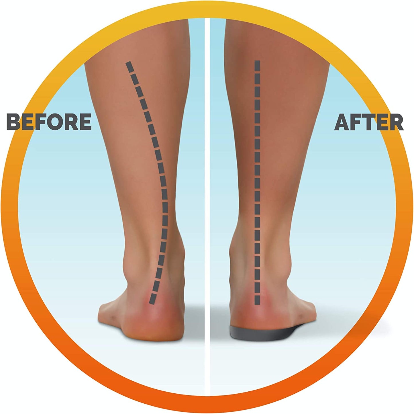Scholl In Balance Lower Back Orthotic Insole Large - Cutprice Online