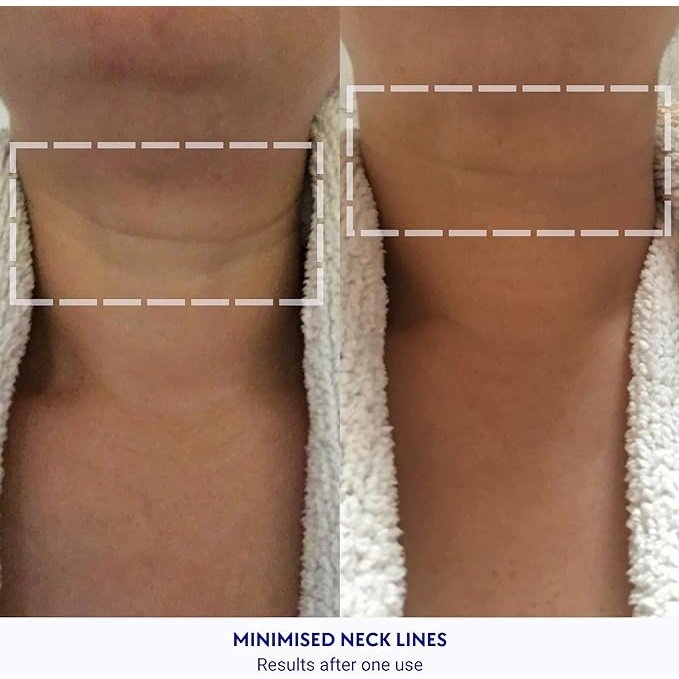 Wrinkles Schminkles Neck Wrinkle Patch Single - Cutprice Online