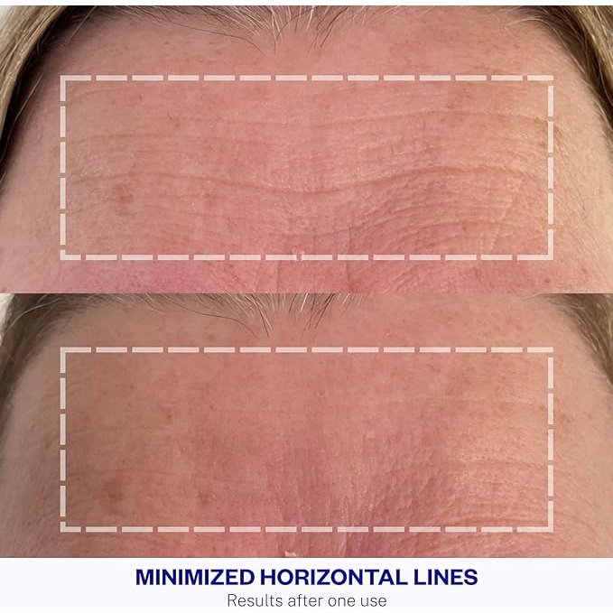 Wrinkles Schminkles Forehead Wrinkle Patch Single - Cutprice Online