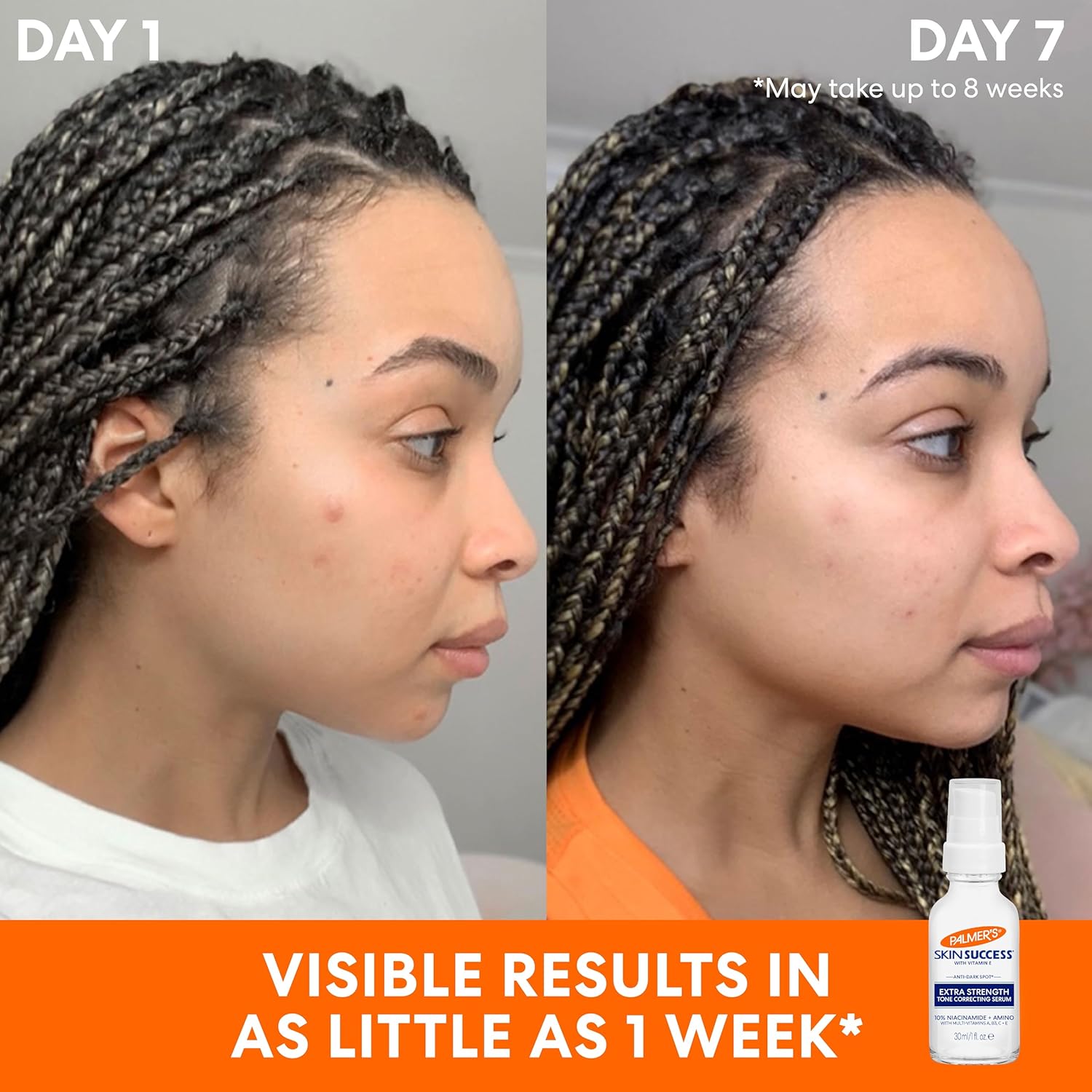 Palmers Skin Success Extra-Strength Tone Correcting Serum 30ml