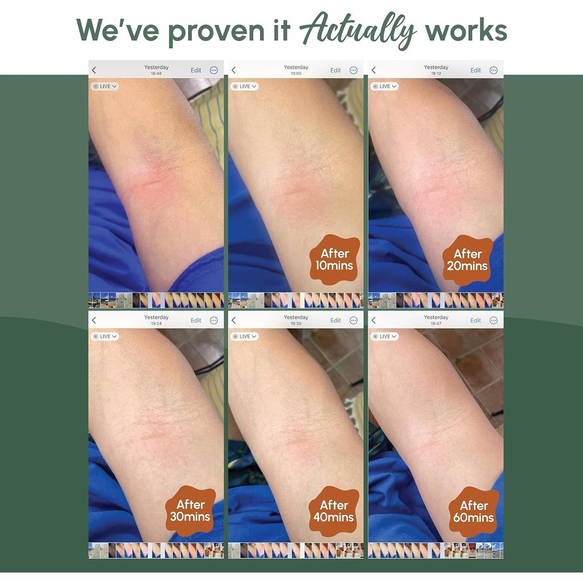 Good Riddance Rescue Balm 10g