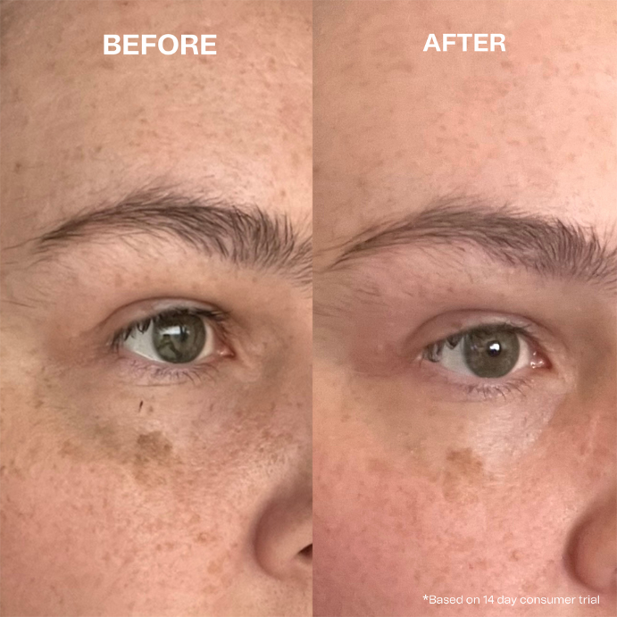 Hey Bud Kojic Acid + Alpha Arbutin Pigmentation Treatment 30mL