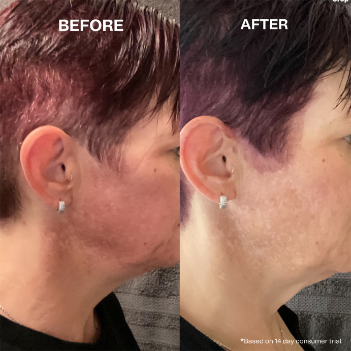 Hey Bud Kojic Acid + Alpha Arbutin Pigmentation Treatment 30mL
