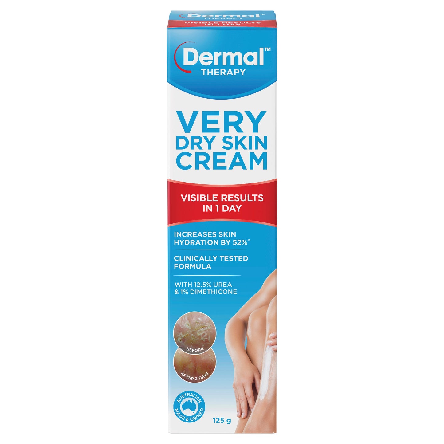 Dermal Therapy Very Dry Skin Cream 125g - Cutprice Online