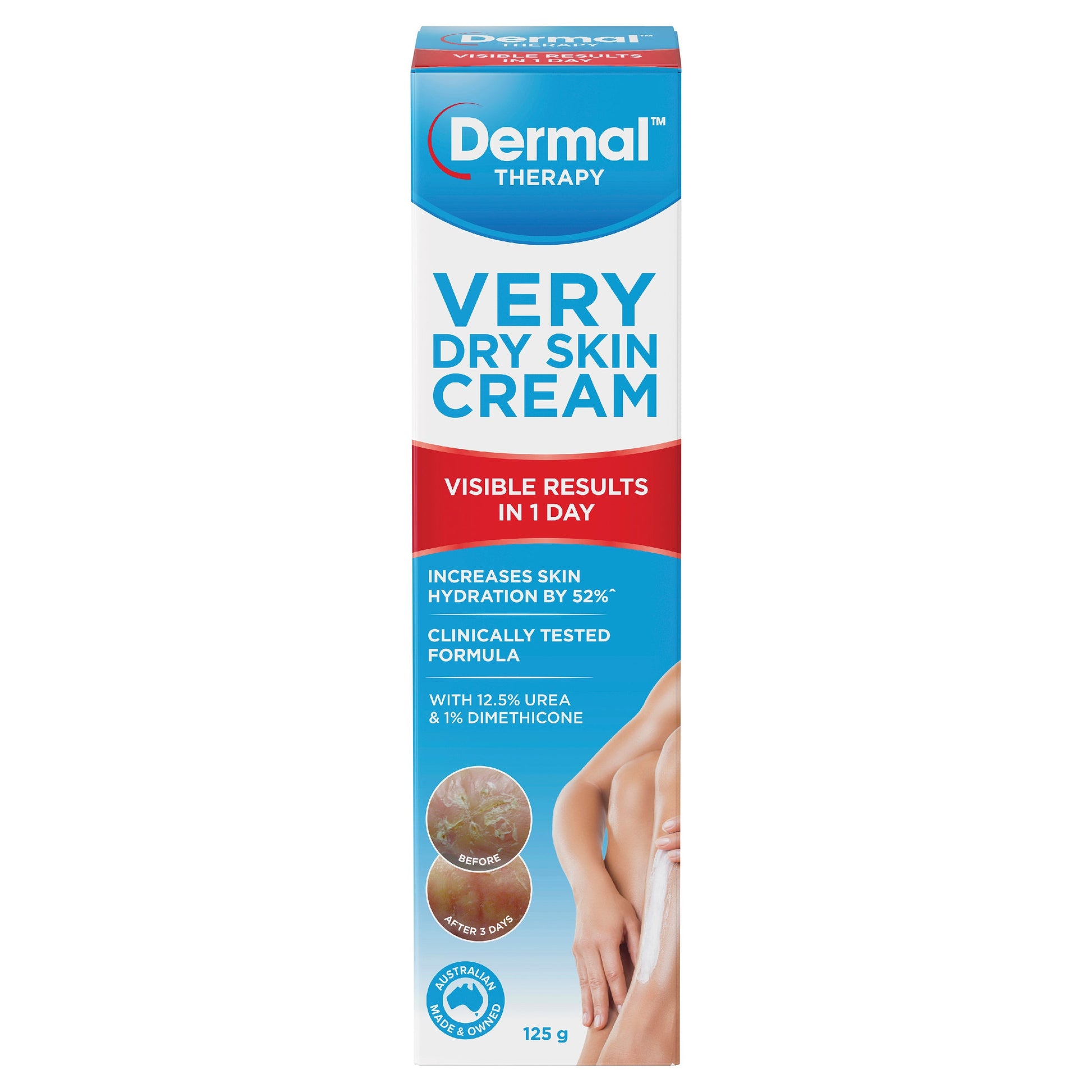 Dermal Therapy Very Dry Skin Cream 125g - Cutprice Online