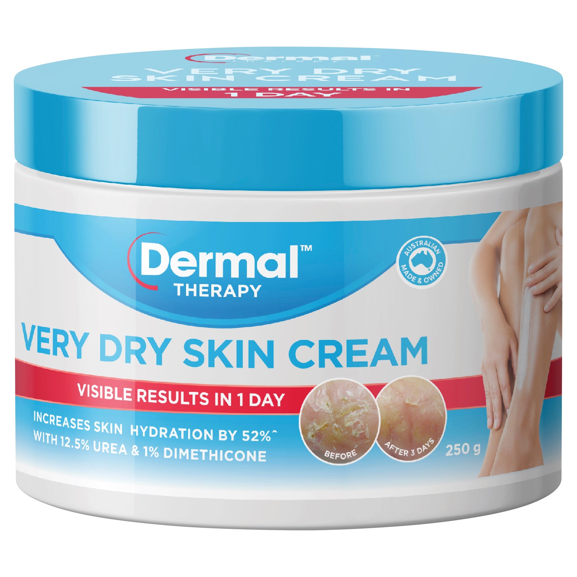 Dermal Therapy Very Dry Skin Cream  250g - Cutprice Online