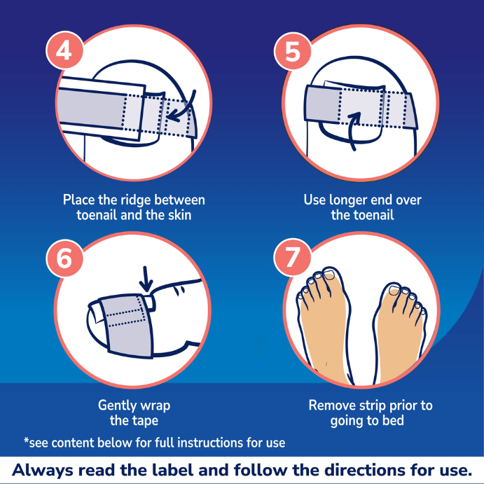 Scholl Ingrown Toenail Pain Relief Strips 6 Pack