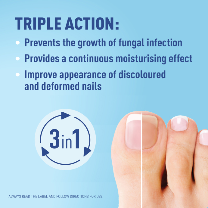 Duofilm by Fungex Nail Fungus Patch 14pk
