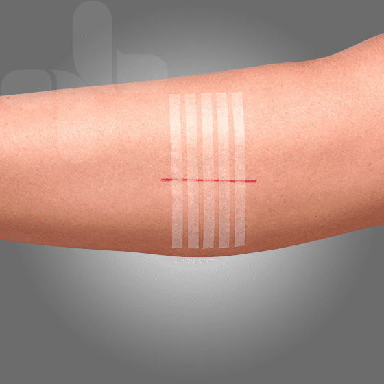 Aeroplast Wound Closure Strips 3 X 75mm 5 Strips