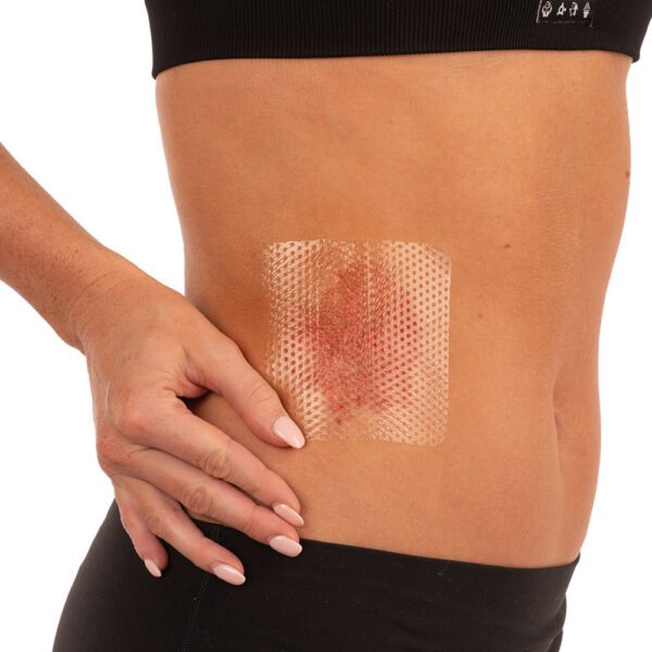 AEROWOUND Silicone Wound Contact Dressing 10 x 10cm 10PK