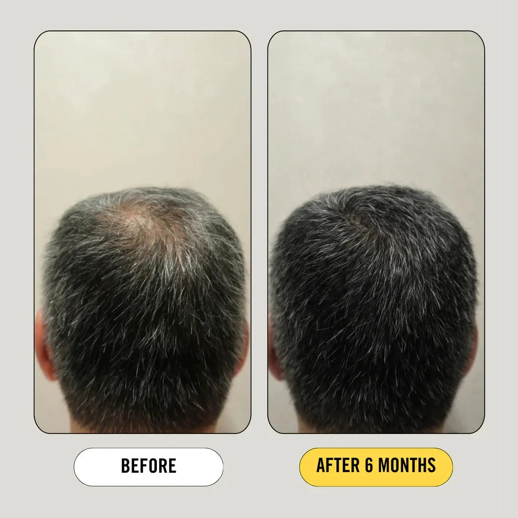 Growth Bomb Regrowth Assist Support for Thinning Hair Supplement 30 Capsules