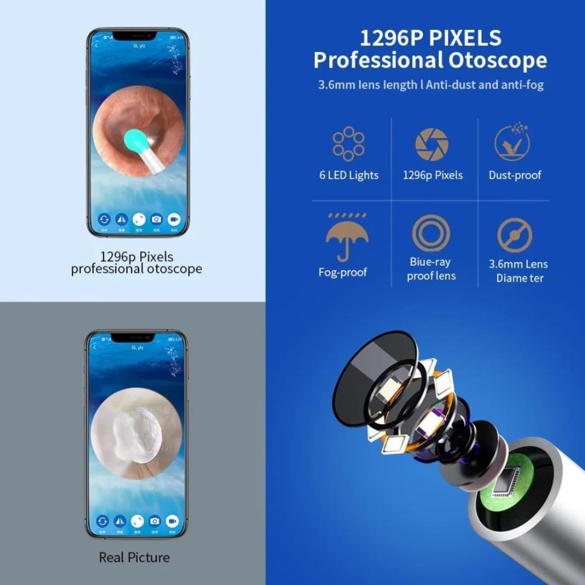 NE3 Visual Ear Wax Removal Tool
