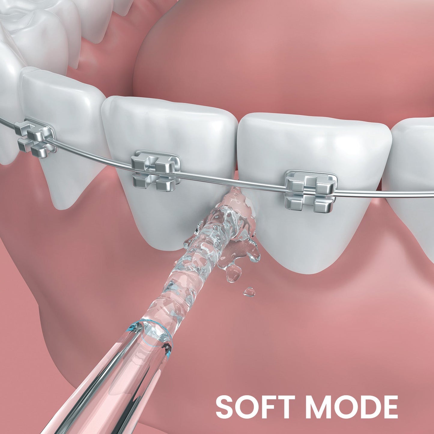 GO2 Dentagenie Water Flosser - Cutprice Online