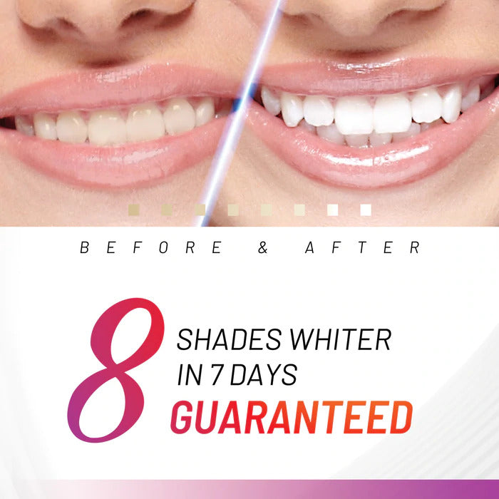 White Glo White Accelerator Blue Light Teeth Whitening System - Cutprice Online